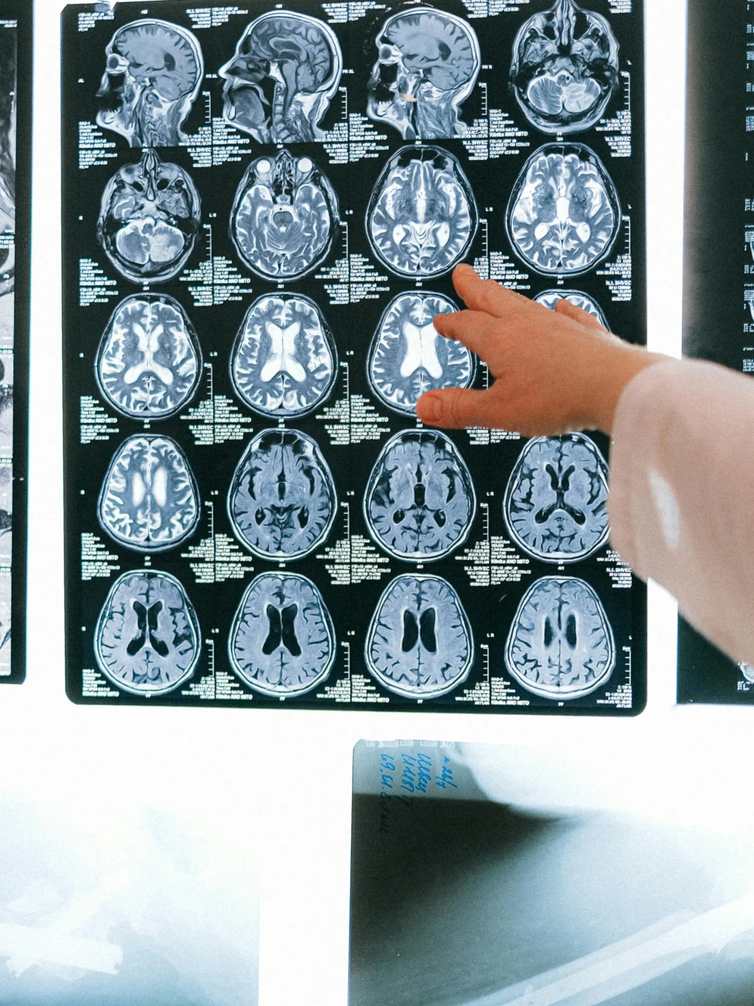 dfc2b6b6edb58c28b056755afe9a99cdc04f4be2